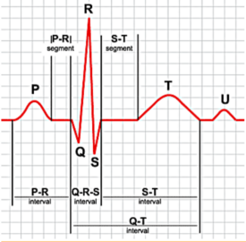 EKG>