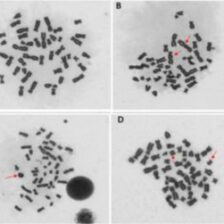 Poškodenie DNA u ľudí žijúcich v bezprostrednej blízkosti vysielačov